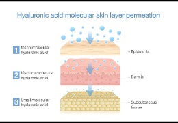 如何選擇適合油痘肌的精華產(chǎn)品？