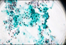 微生物發(fā)酵緒論--發(fā)酵工程的前世今生1